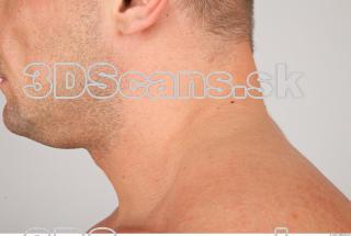 Neck texture of Gene 0004